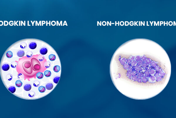 Hodgkin VS Non-Hodgkin Lymphoma