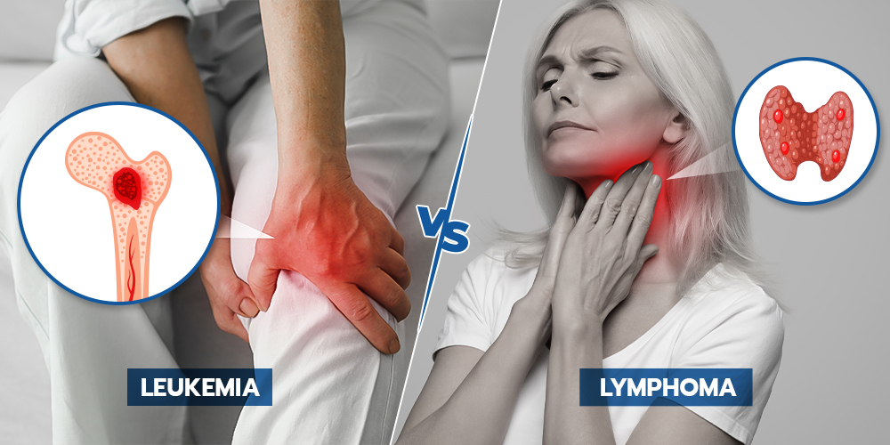 Understanding Leukemia vs Lymphoma