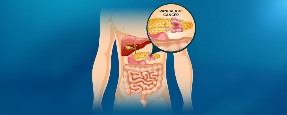 Fungating Breast Cancer: When Cancer Looks Like a Fungus