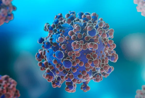 Anaplastic Large Cell Lymphoma