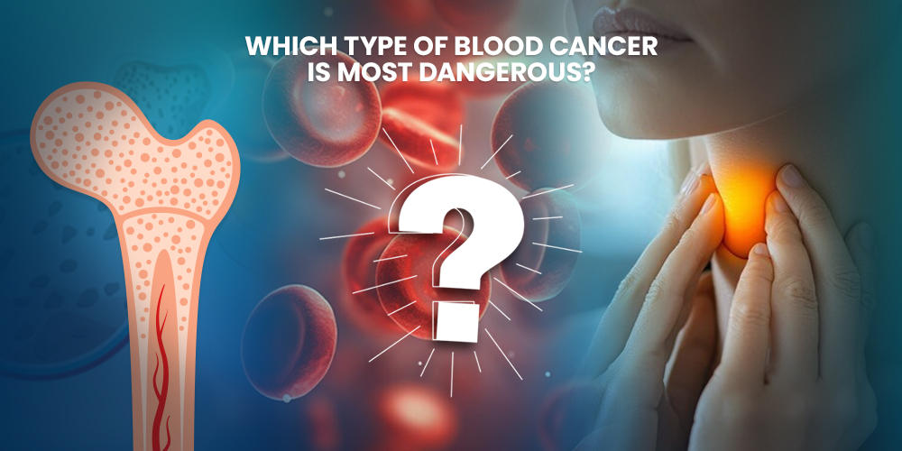 Which Type of Blood Cancer is Most Dangerous?