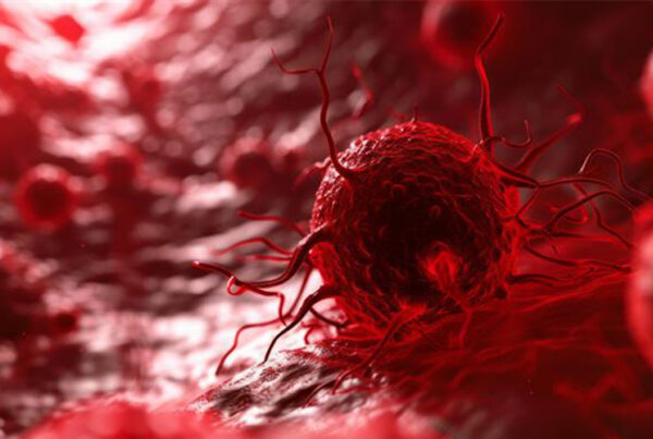What is Blood Cancer? Types, Causes & Symptoms