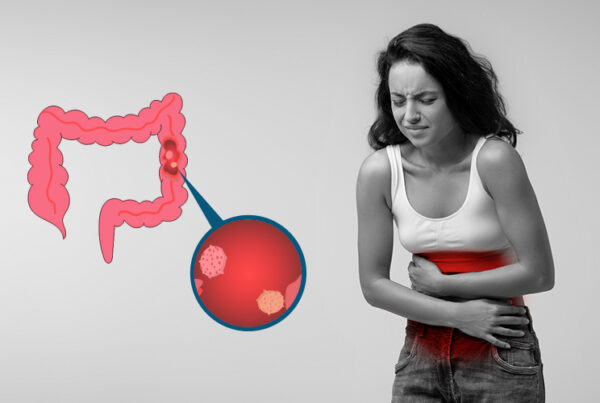 How Serious is a Tubular Adenoma