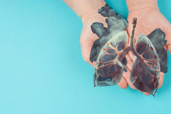 Metastatic Lung Cancer