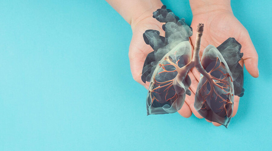 Metastatic Lung Cancer