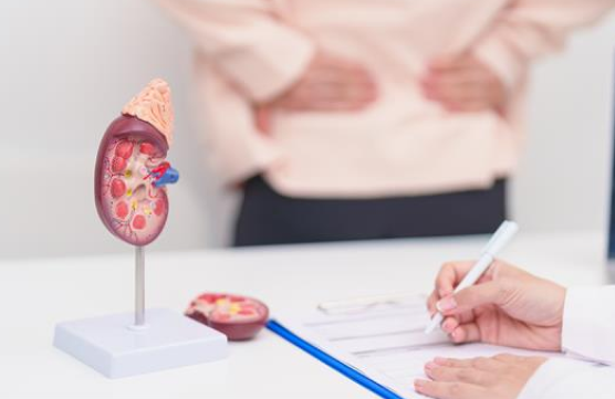 Renal cell carcinoma