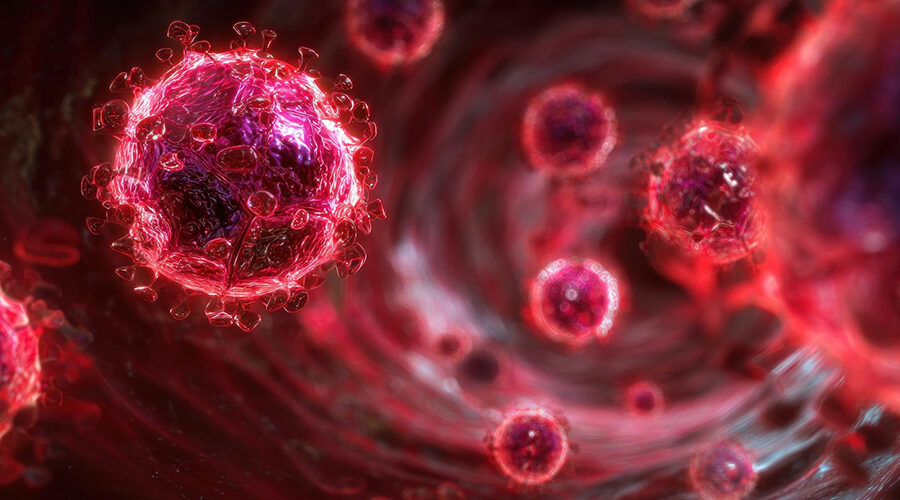 Adenocarcinoma