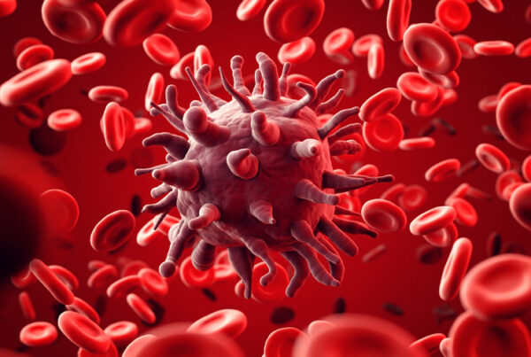 How Bad is Lymphoma Cancer