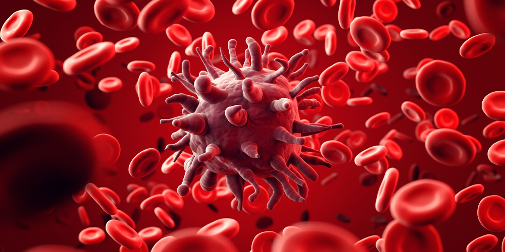 How Bad is Lymphoma Cancer