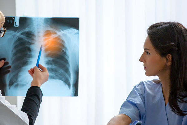 Lung Tumor