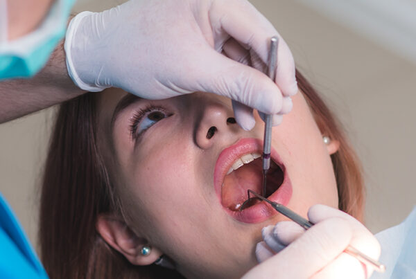 Soft Palate Cancer
