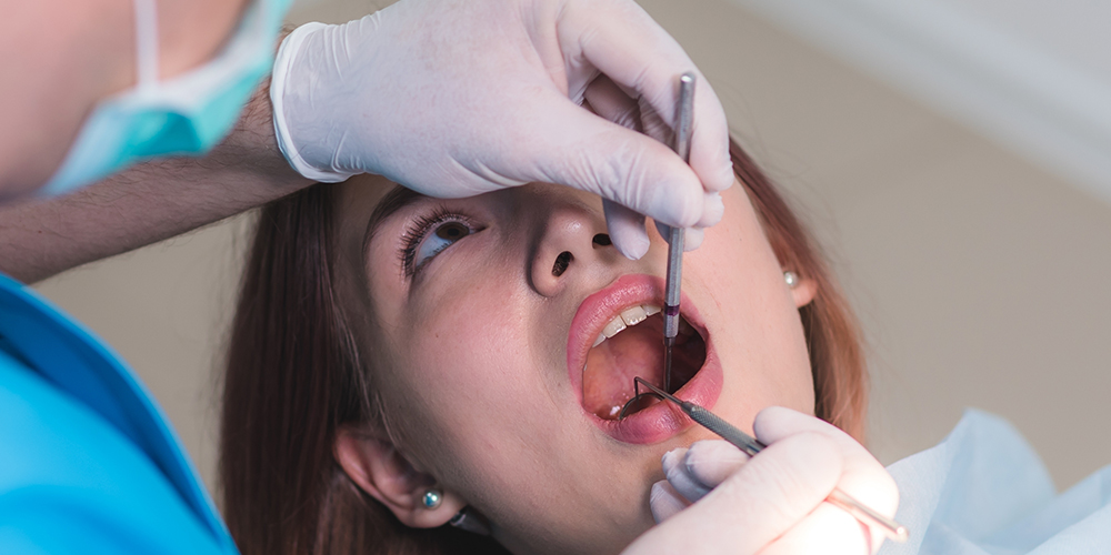 Soft Palate Cancer