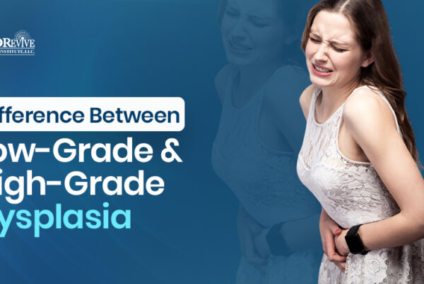 Low-Grade vs High-Grade Dysplasia