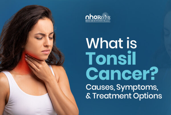 tonsil cancer