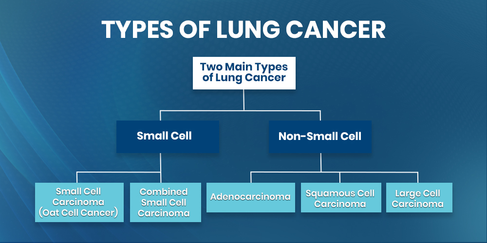 Types of Lung Cancer