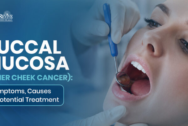 Buccal Mucosa Cancer