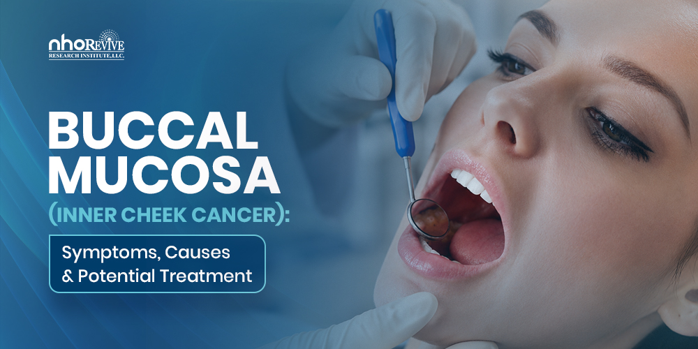 Buccal Mucosa Cancer