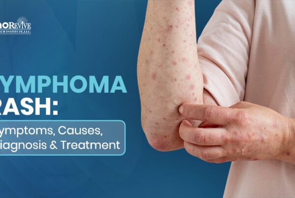 Lymphoma Rash