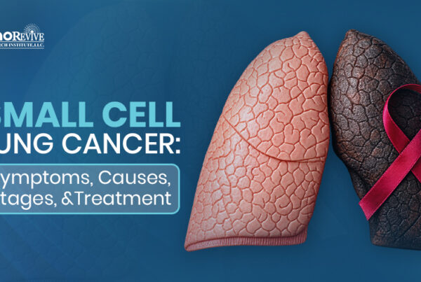 Small Cell Lung Cancer