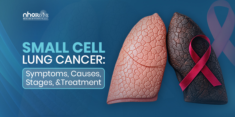 Small Cell Lung Cancer