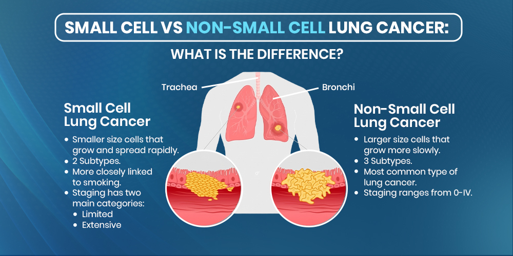 Small Cell vs Non-Small Cell Lung Cancer types
