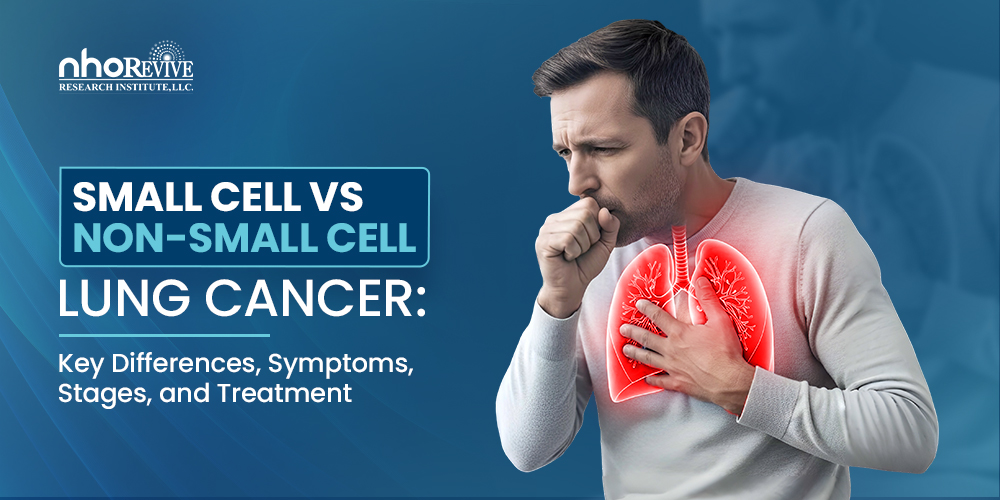 Small Cell vs Non-Small Cell Lung Cancer