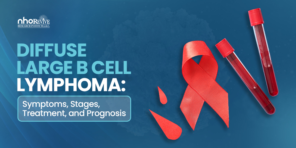 Diffuse Large B Cell Lymphoma