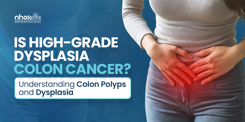 Is High-Grade Dysplasia Colon Cancer