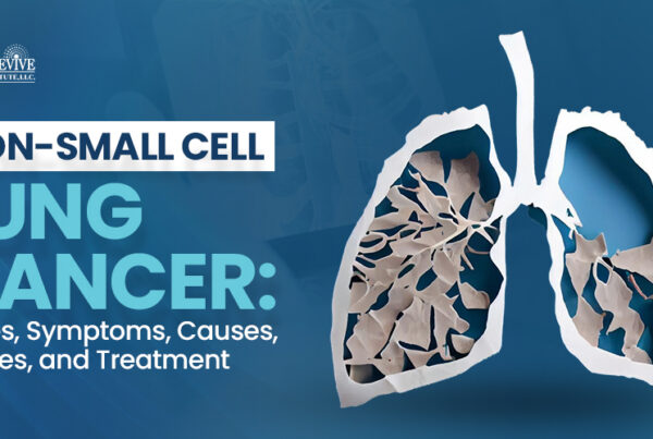 Non Small Cell Lung Cancer