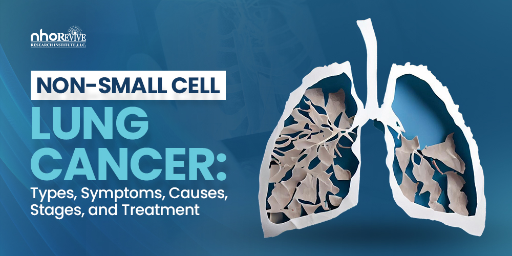 Non Small Cell Lung Cancer
