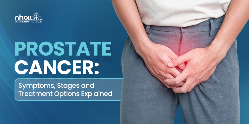 Prostate Cancer
