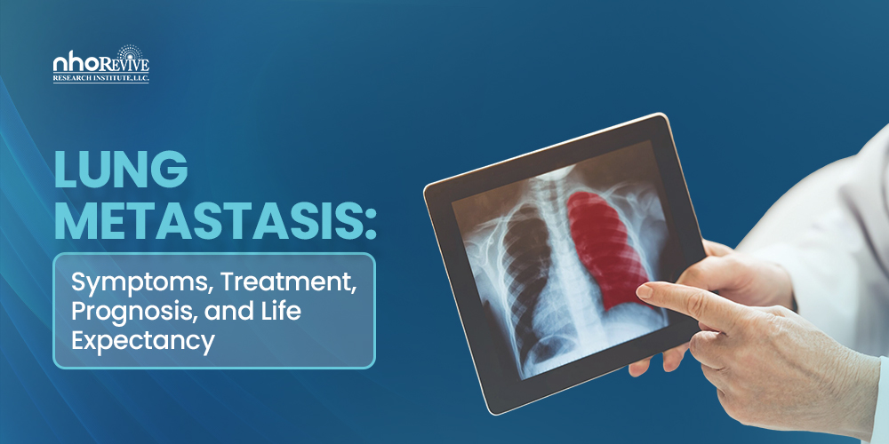 Lung Metastasis
